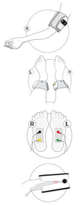 Clinic staff preparing a TM-Flow assessment that uses disposable foot electrodes at HealthWright Technologies